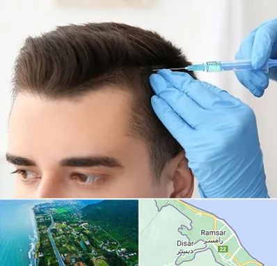 مزوتراپی مو در رامسر