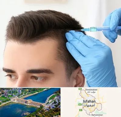 مزوتراپی مو در اصفهان