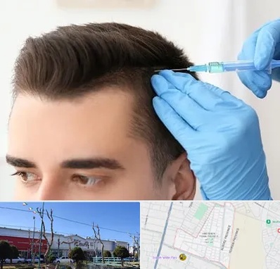 مزوتراپی مو در فاز دو اندیشه