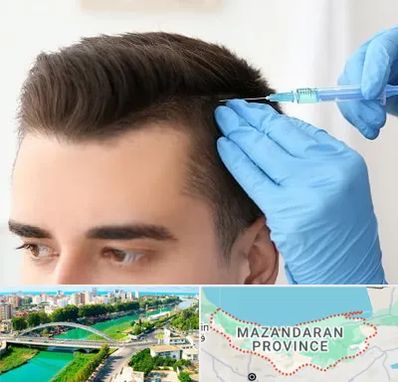 مزوتراپی مو در مازندران