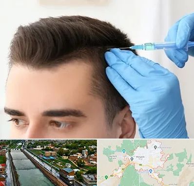 مزوتراپی مو در مراغه