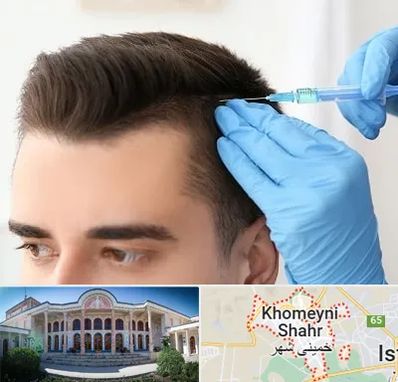 مزوتراپی مو در خمینی شهر