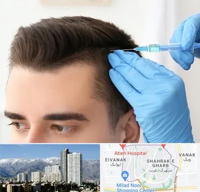 مزوتراپی مو در شهرک غرب تهران