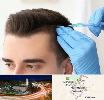 مزوتراپی مو در همدان