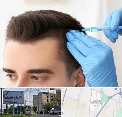 مزوتراپی مو در فاز یک اندیشه
