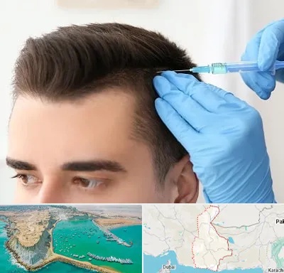 مزوتراپی مو در سیستان و بلوچستان