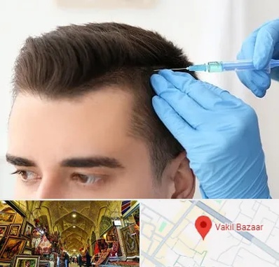 مزوتراپی مو در بازار وکیل شیراز