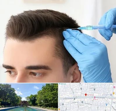 مزوتراپی مو در هشت بهشت اصفهان