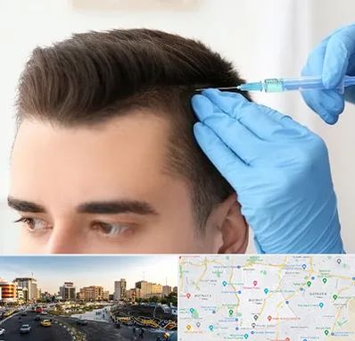 مزوتراپی مو در منطقه 7 تهران