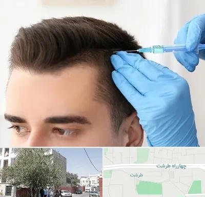 مزوتراپی مو در طرشت