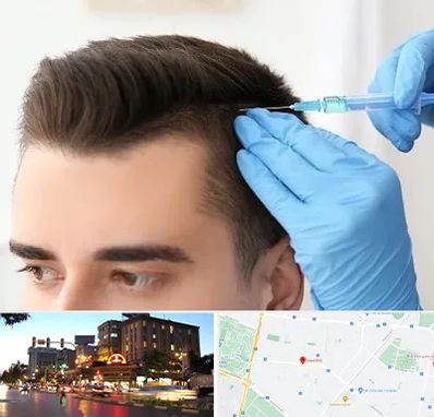 مزوتراپی مو در بلوار سجاد مشهد