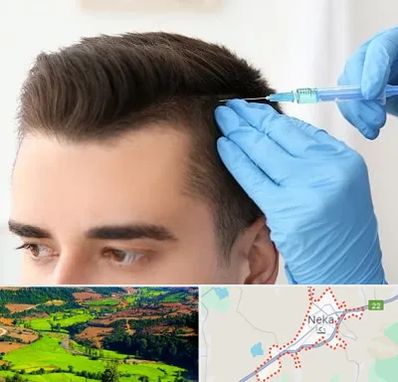 مزوتراپی مو در نکا