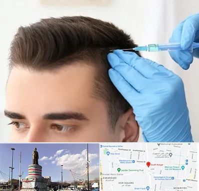 مزوتراپی مو در کارگر جنوبی