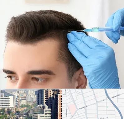 مزوتراپی مو در خیابان بهشتی