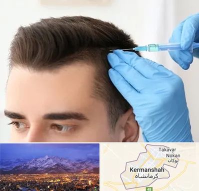 مزوتراپی مو در کرمانشاه