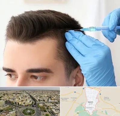 مزوتراپی مو در قزوین