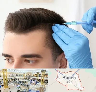 مزوتراپی مو در بانه