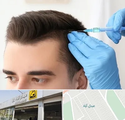 مزوتراپی مو در عبدل آباد
