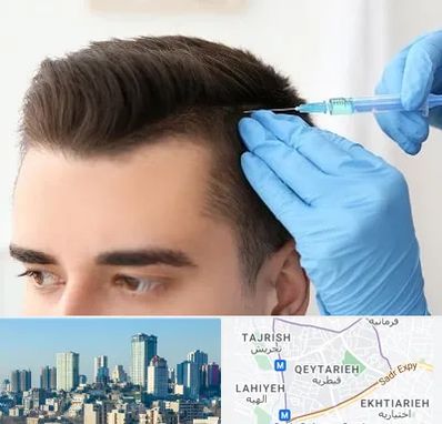 مزوتراپی مو در قیطریه