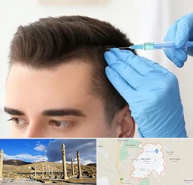 مزوتراپی مو در مرودشت