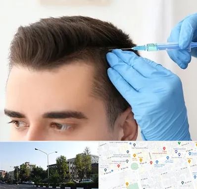 مزوتراپی مو در میدان کاج