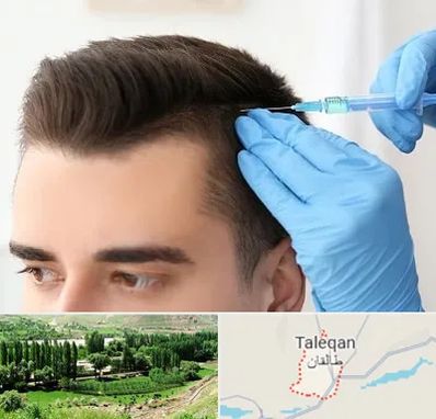 مزوتراپی مو در طالقان