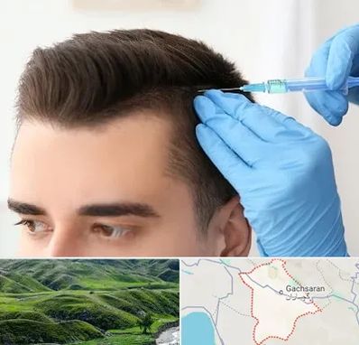 مزوتراپی مو در گچساران
