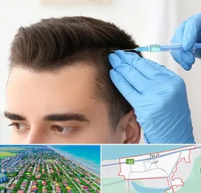 مزوتراپی مو در نور