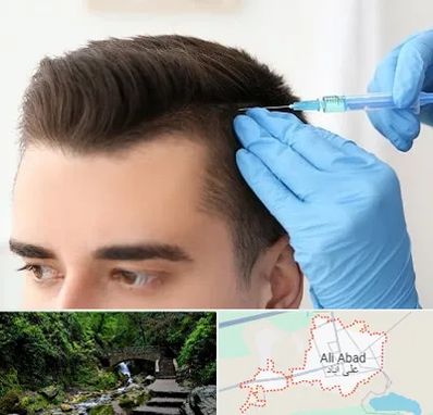 مزوتراپی مو در علی آباد کتول