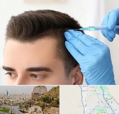 مزوتراپی مو در فرهنگ شهر شیراز