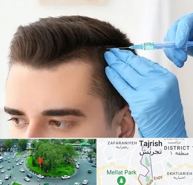 مزوتراپی مو در تجریش