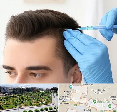 مزوتراپی مو در پردیس