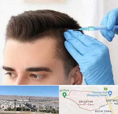 مزوتراپی مو در شهرک گلستان شیراز