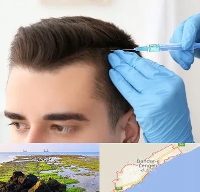 مزوتراپی مو در بندرلنگه