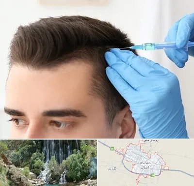 مزوتراپی مو در شیروان
