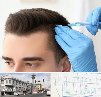 مزوتراپی مو در 17شهریور