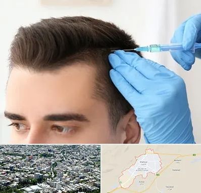 مزوتراپی مو در شاهرود