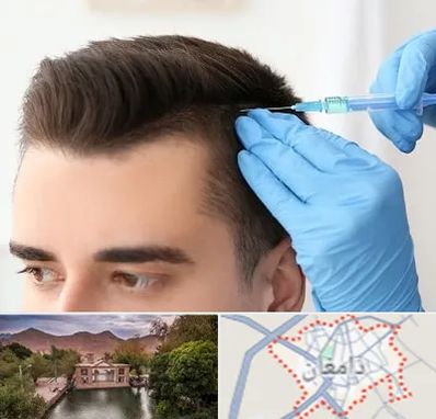 مزوتراپی مو در دامغان
