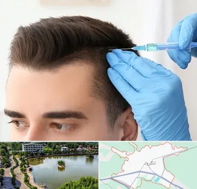 مزوتراپی مو در لنگرود