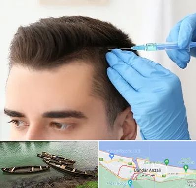 مزوتراپی مو در بندر انزلی