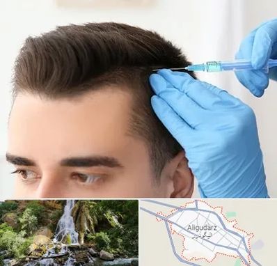 مزوتراپی مو در الیگودرز