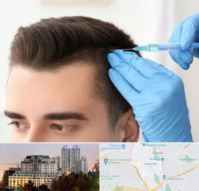 مزوتراپی مو در فرشته