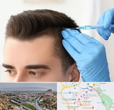 مزوتراپی مو در معالی آباد شیراز