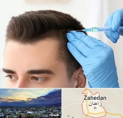 مزوتراپی مو در زاهدان