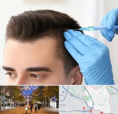 مزوتراپی مو در ولیعصر ارومیه