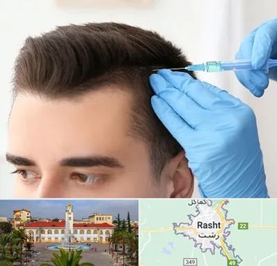 مزوتراپی مو در رشت