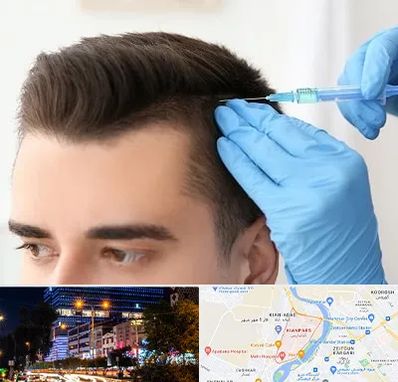 مزوتراپی مو در کیانپارس اهواز