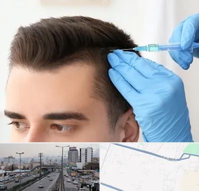 مزوتراپی مو در بلوار ارتش