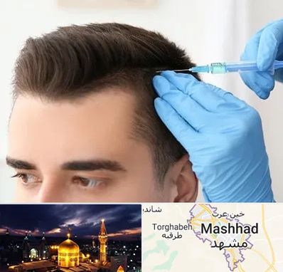 مزوتراپی مو در مشهد