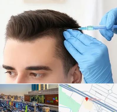 مزوتراپی مو در لاله پارک تبریز